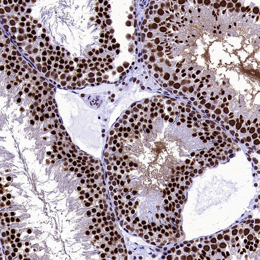 U2AF1 Recombinant Rabbit mAb (S-2384)