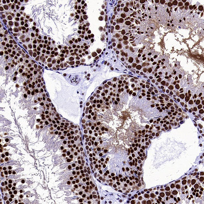 U2AF1 Recombinant Rabbit mAb (S-2384)