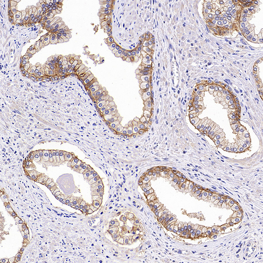 CXADR Recombinant Rabbit mAb (S-4349-1)