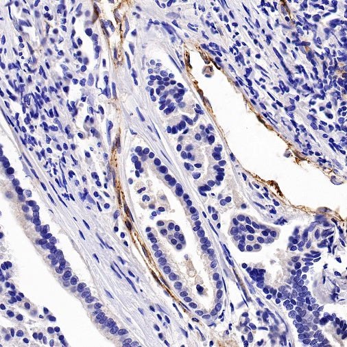 Von Willebrand Factor Recombinant Rabbit mAb (S-663-120)