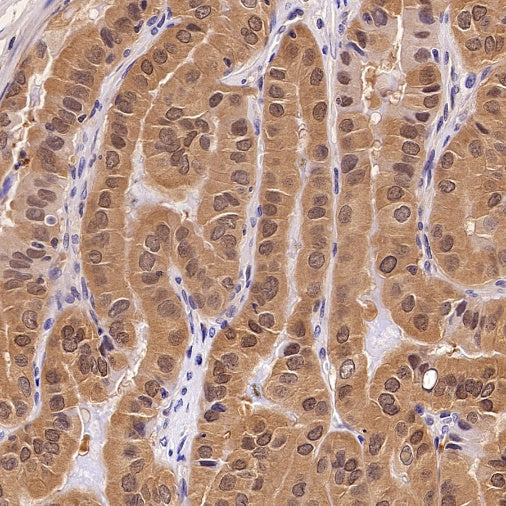 Hint1 Recombinant Rabbit mAb (S-2693-67)