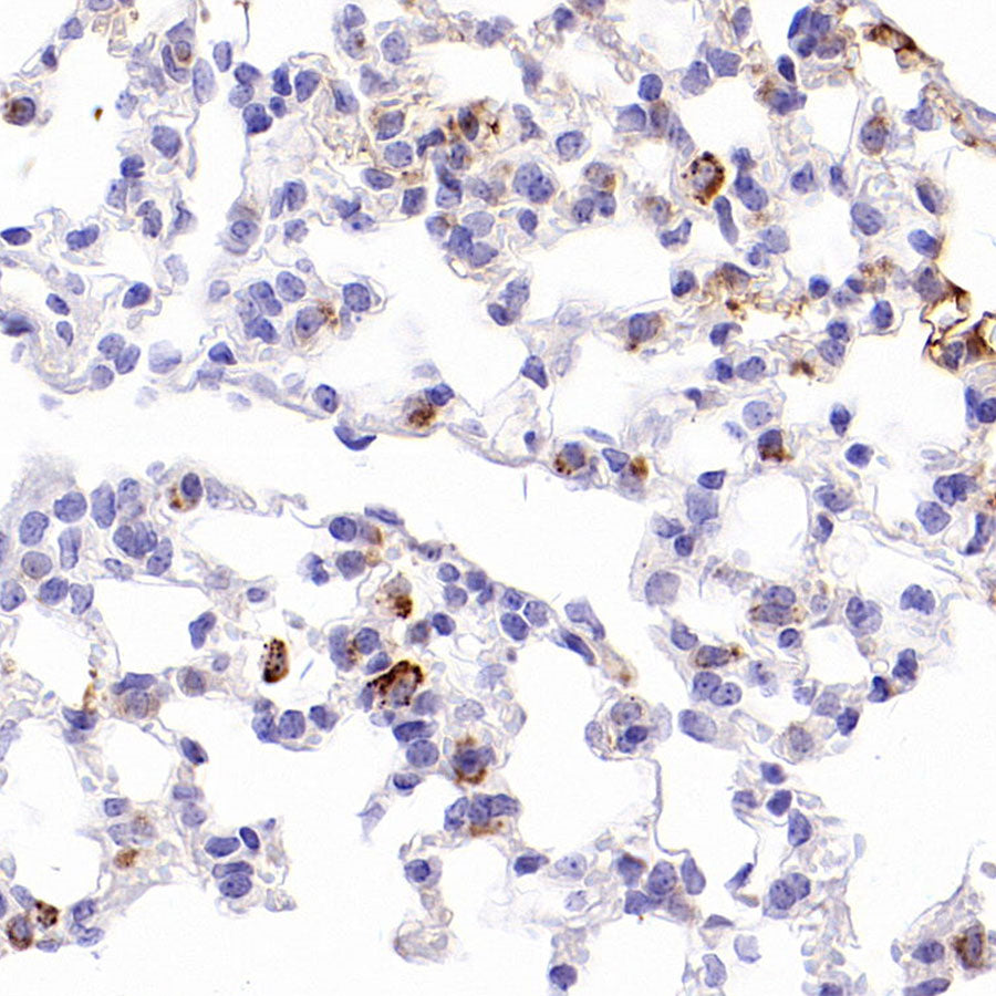 Napsin A Recombinant Mouse mAb (SDT-4204)