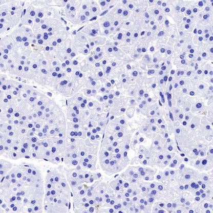 Glucagon Recombinant Rabbit mAb (S-365-17)