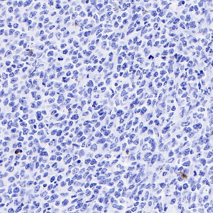 LAG3 Recombinant Rabbit mAb (S-671-74)