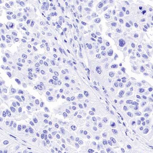 AKAP4 Recombinant Rabbit mAb (SDT-4196)