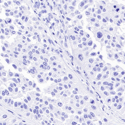 AKAP4 Recombinant Rabbit mAb (SDT-4196)