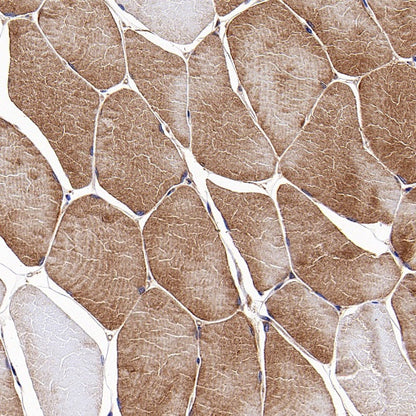Mitofusin 2 Recombinant Rabbit mAb (S-1783-49)