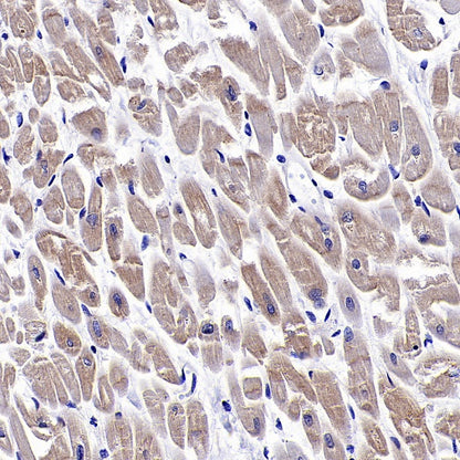 Hamartin/TSC1 Recombinant Rabbit mAb (S-2725-166)