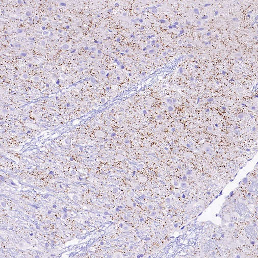 VGLUT3 Recombinant Rabbit mAb (S-2430-26)