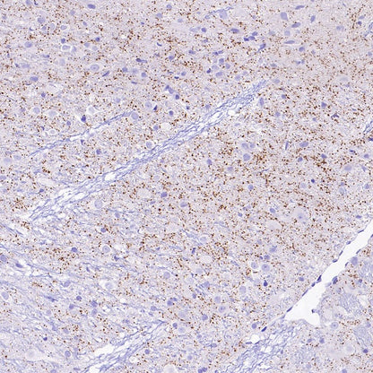 VGLUT3 Recombinant Rabbit mAb (S-2430-26)