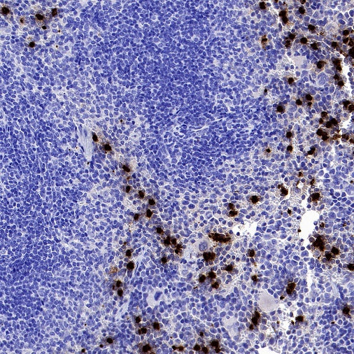 Lipocalin-2/NGAL Recombinant Rabbit mAb (S-2280-129)