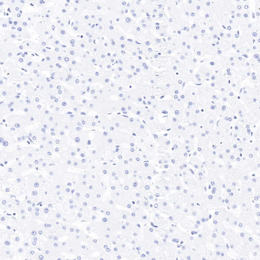 Myoglobin Recombinant Rabbit mAb (SDT-097-10)
