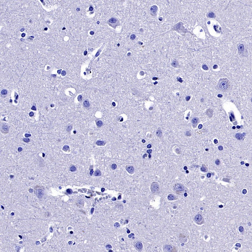 Uteroglobin Recombinant Rabbit mAb (SDT-2736-46)
