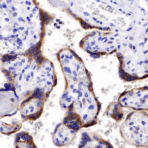 Progranulin Recombinant Rabbit mAb (S-2202-59)