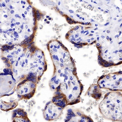 Progranulin Recombinant Rabbit mAb (S-2202-59)