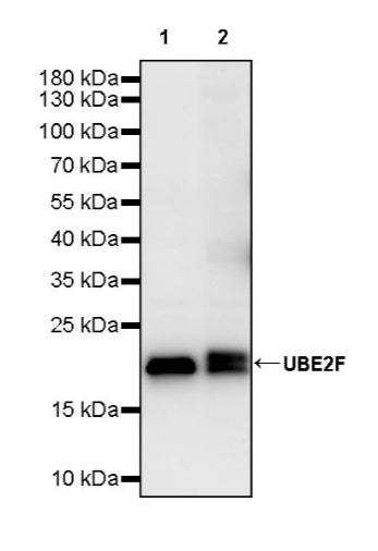 UBE2F Recombinant Rabbit mAb (S-2672-26)
