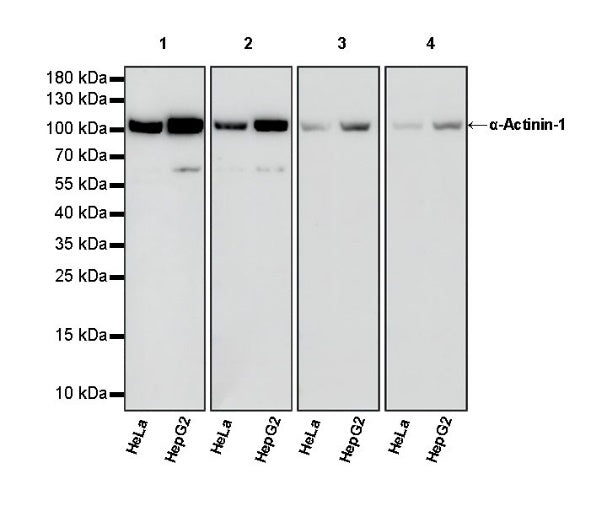 α-Actinin-1 Recombinant Rabbit mAb (HRP Conjugate) (SDT-311-20)