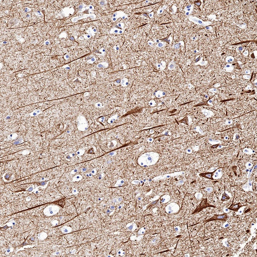 Neurofilament L Recombinant Rabbit mAb (S-635-214)