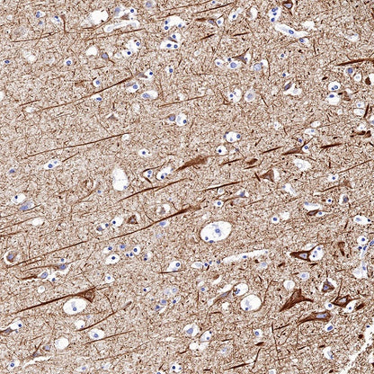 Neurofilament L Recombinant Rabbit mAb (S-635-214)