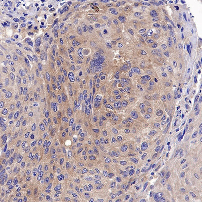 IDE Recombinant Rabbit mAb (S-1051-61)