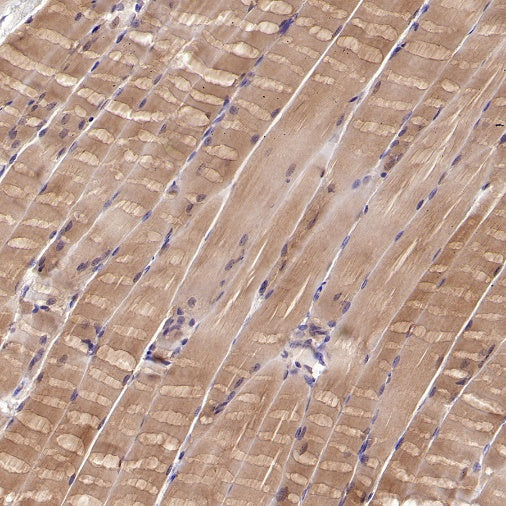 Lactate Dehydrogenase Rabbit Polyclonal Antibody