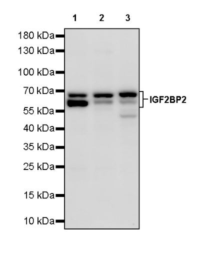 IGF2BP2 Rabbit Polyclonal Antibody