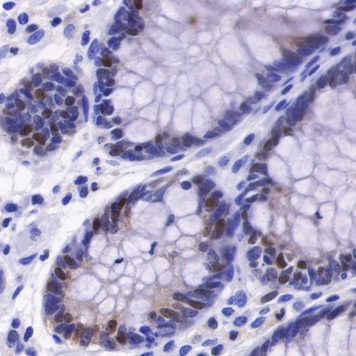 IL-18 Recombinant Rabbit mAb (S-2142-2)