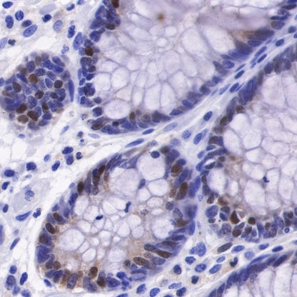 IL-18 Recombinant Rabbit mAb (S-2142-2)