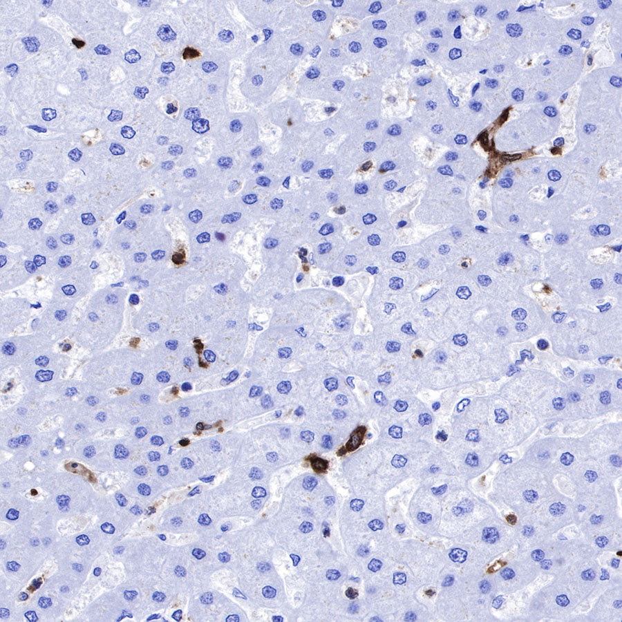 Stathmin 1 Recombinant Rabbit mAb (SDT-383-4)