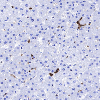 Stathmin 1 Recombinant Rabbit mAb (SDT-383-4)