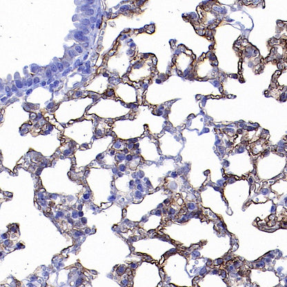 SLIT2 Recombinant Rabbit mAb (S-730-41)