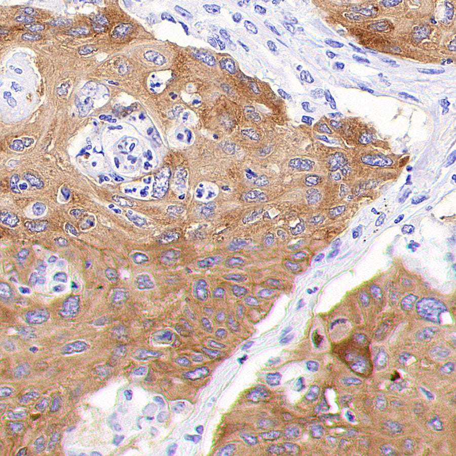 IMP3 Recombinant Rabbit mAb (S-6196)