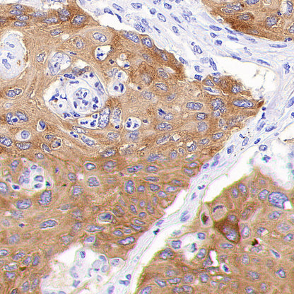IMP3 Recombinant Rabbit mAb (S-6196)