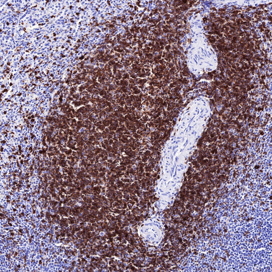 CD7 Recombinant Rabbit mAb,PBS Only (SDT-R165)