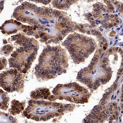 b-FGF/FGF2 Recombinant Rabbit mAb (S-1161-136)