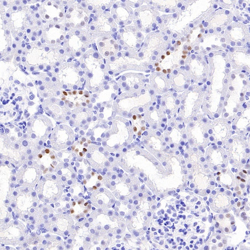 AP2α Recombinant Rabbit mAb (S-2376-7)