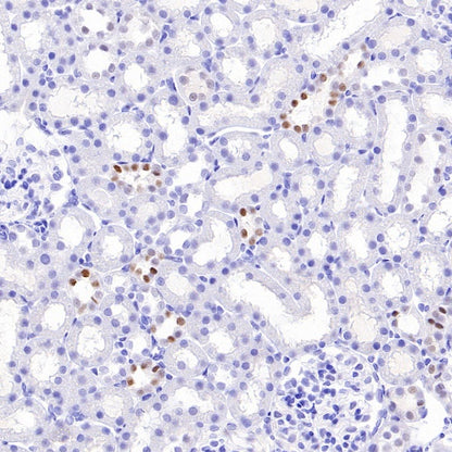 AP2α Recombinant Rabbit mAb (S-2376-7)