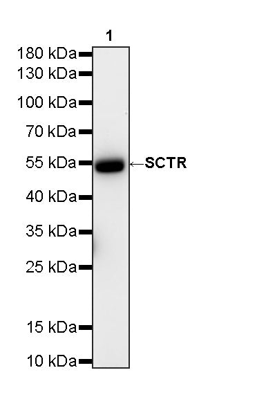 SCTR Recombinant Rabbit mAb (S-3949-52)