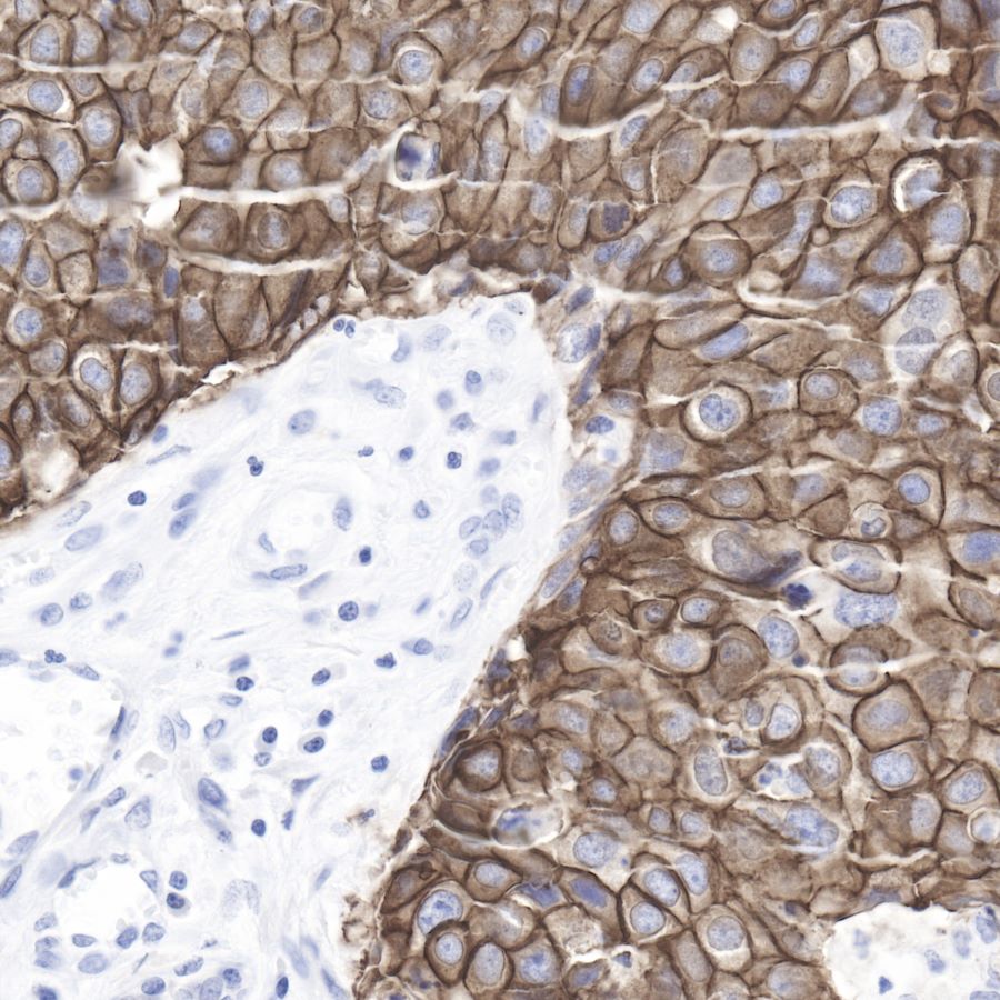 S-RMab® ErbB2 Recombinant Rabbit mAb (SDT-069-57)