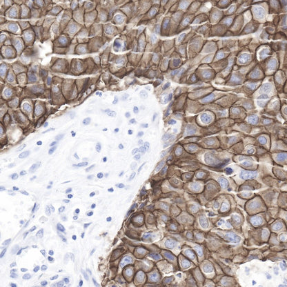 S-RMab® ErbB2 Recombinant Rabbit mAb (SDT-069-57)