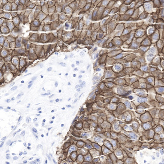 S-RMab® ErbB2 Recombinant Rabbit mAb (SDT-069-57)