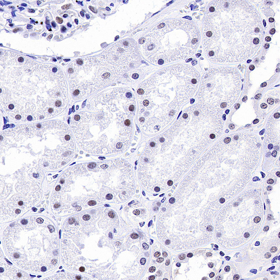 INI-1/SMARCB1 Recombinant Rabbit mAb (S-4068-21)