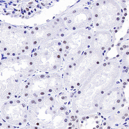 INI-1/SMARCB1 Recombinant Rabbit mAb (S-4068-21)