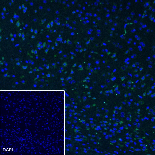 YTHDF1 Recombinant Rabbit mAb (S-2443-28)