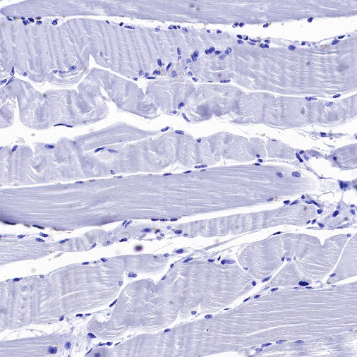 ENPP3/CD203c Recombinant Rabbit mAb (S-1632-11)