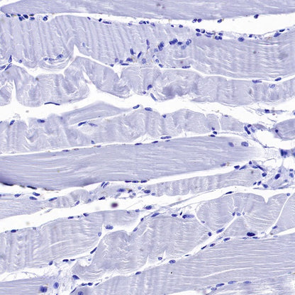 ENPP3/CD203c Recombinant Rabbit mAb (S-1632-11)