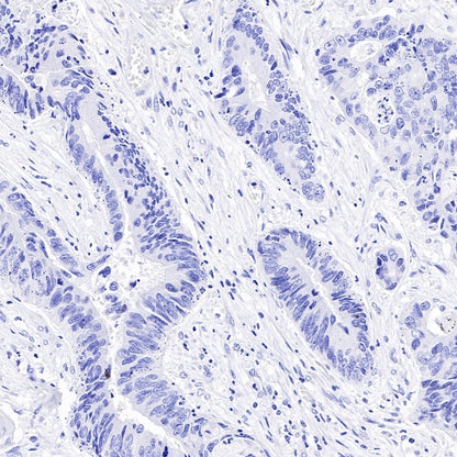 Estrogen Receptor α Recombinant Rabbit mAb (SDT-R371)