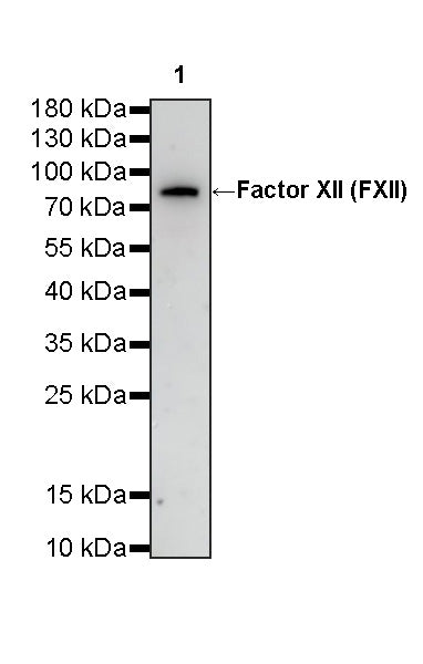 Factor XII (FXII) Recombinant Rabbit mAb (S-4487-31)