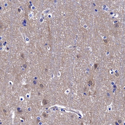 ROCK2 Rabbit Polyclonal Antibody