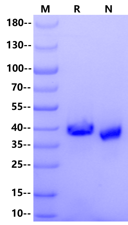 R-spondin-1 Protein, Mouse
